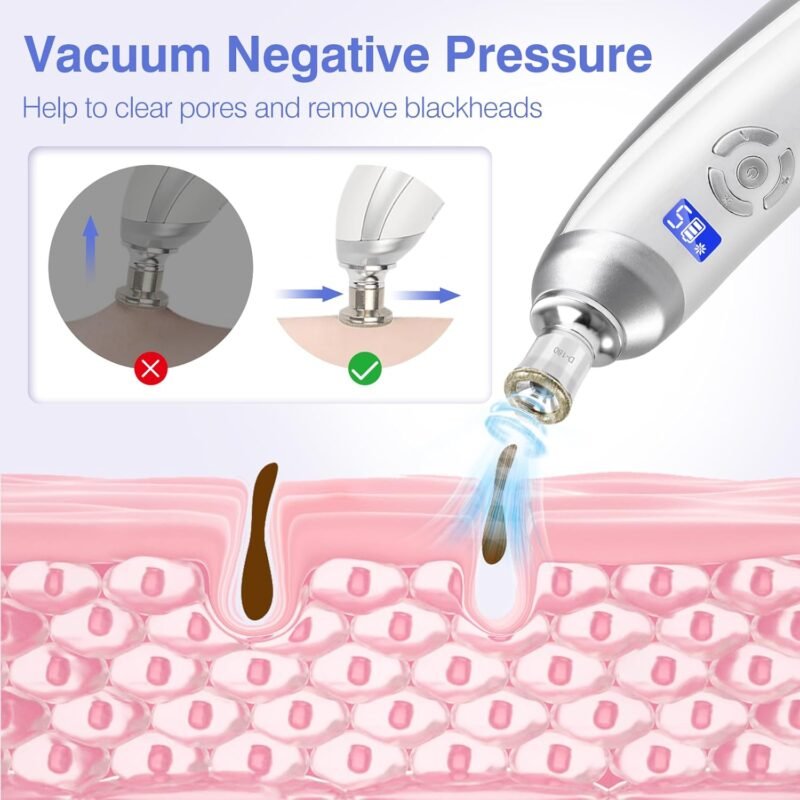 Handheld Personal Crystal Microcrystalline Dermabrasion Machine Deep Cleaning Blackhead Removal Diamond Tip Microcrystalline Dermabrasion Machine