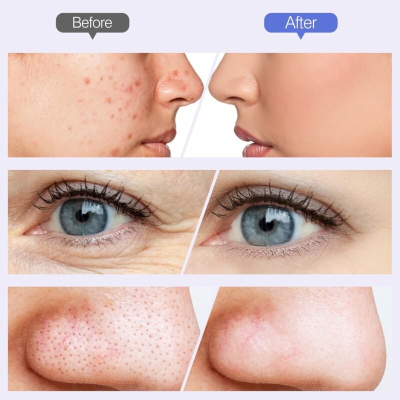 Handheld Personal Crystal Microcrystalline Dermabrasion Machine Deep Cleaning Blackhead Removal Diamond Tip Microcrystalline Dermabrasion Machine
