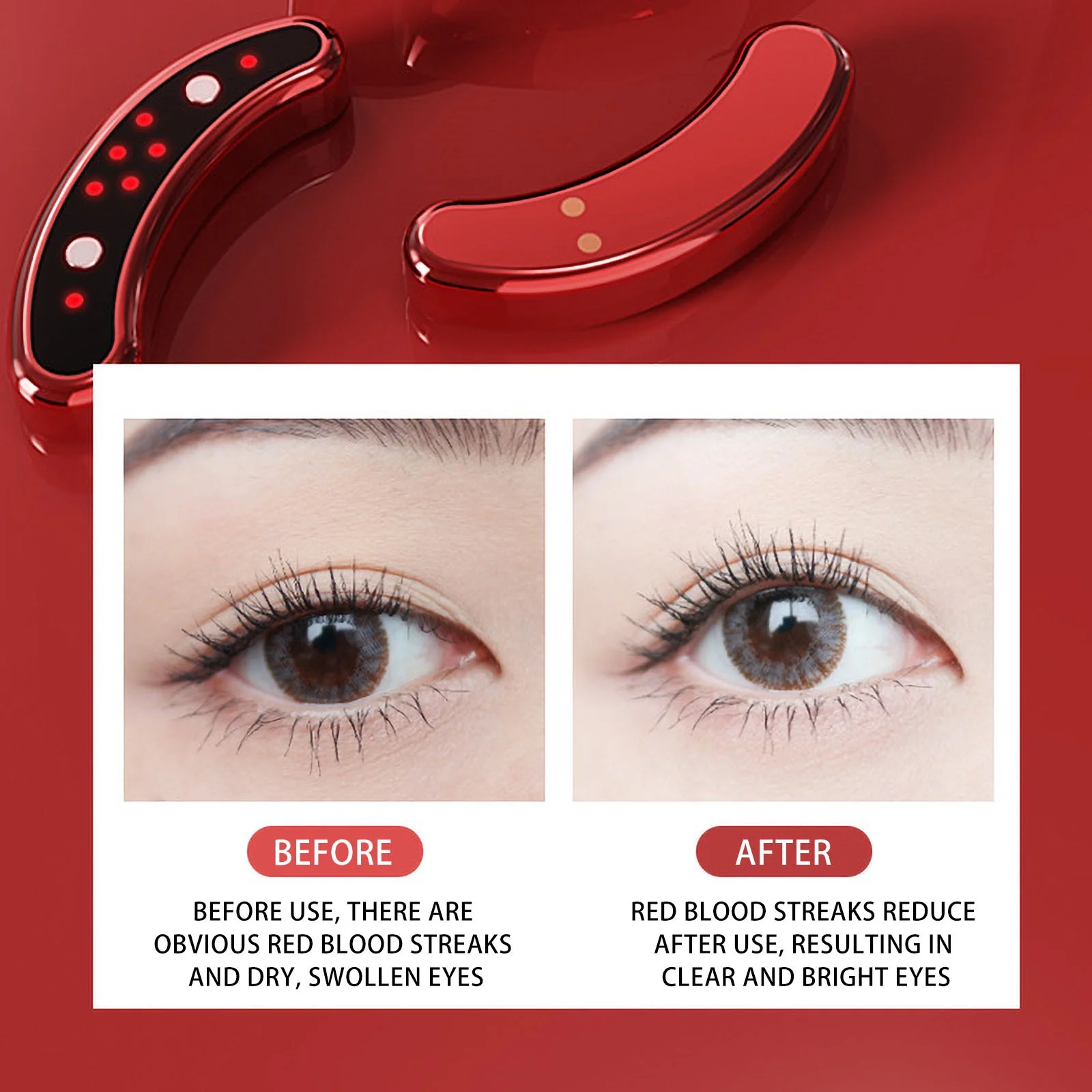 Fashion EMS Eye Massager Reduces Dark Circles Eyeliner Anti-Wrinkle Red Light Anti-Aging Eye Care Tools