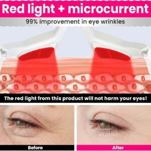 Professional Eye Wrinkle Massager with Light Emitting Diode Red Light Electric Wireless Eye Beauty Instrument