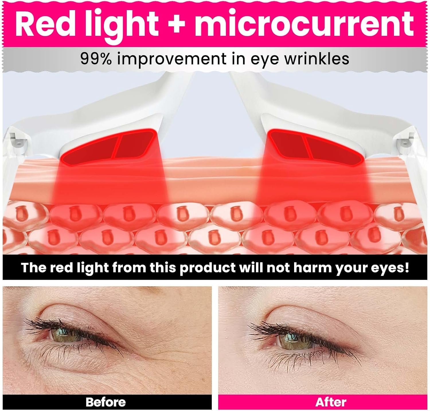 Professional Eye Wrinkle Massager with Light Emitting Diode Red Light Electric Wireless Eye Beauty Instrument