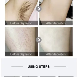 T1-final-detail2 Ice-Cooling IPL Hair Removal Device for Women & Men, 5 Energy Levels, Auto/Manual Flash for Face, Arms, Legs, Bikini & Underarm