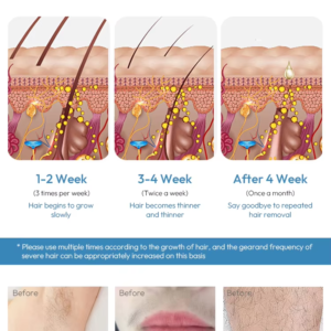 Super Ice-Cooling Fast IPL Hair Removal Device, High-Speed Auto Flash, 5 Levels, Home Permanent Hair Reduction for Women and Men