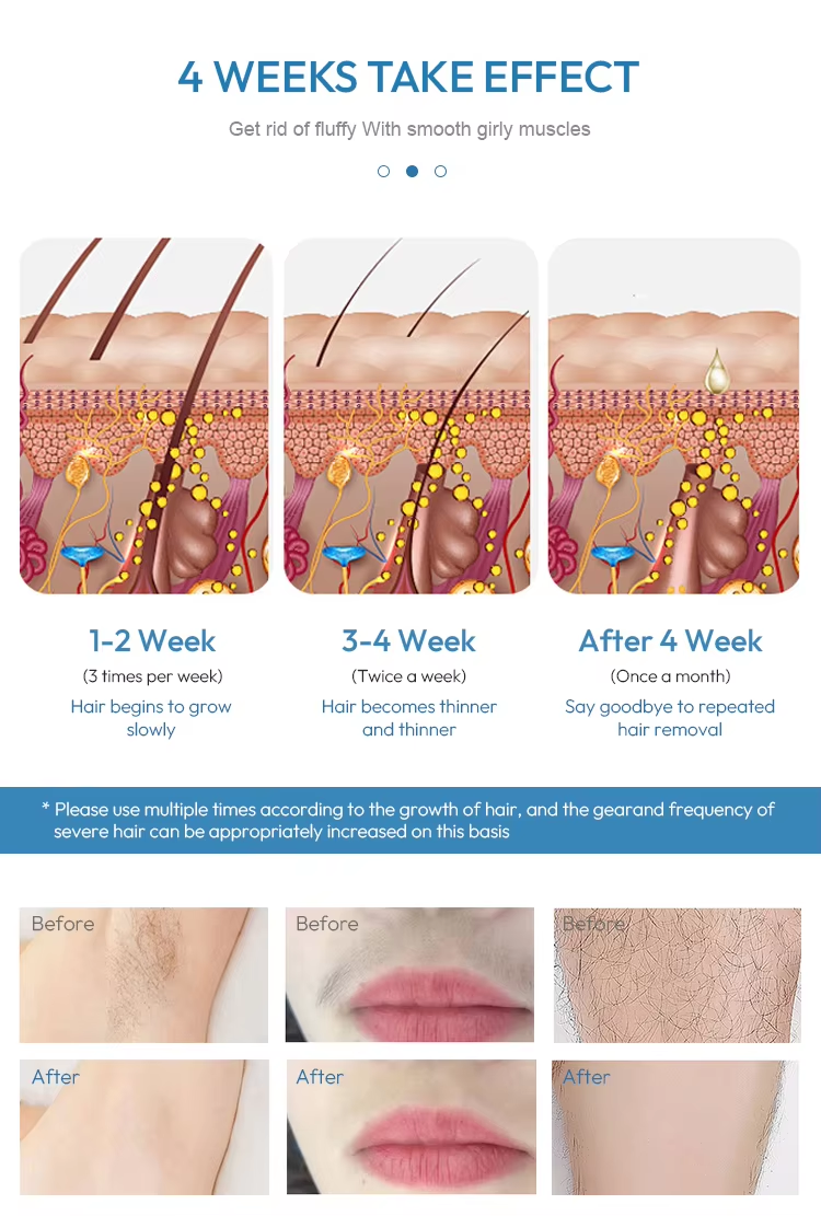 Super Ice-Cooling Fast IPL Hair Removal Device, High-Speed Auto Flash, 5 Levels, Home Permanent Hair Reduction for Women and Men